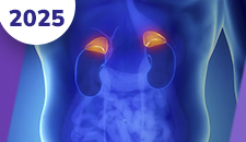 Carcinomas da adrenal, feocromocitomas e paragangliomas