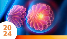 Mama: doença localizada adjuvância