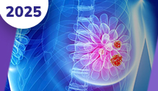 Mama: doença localizada neoadjuvância