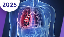 Pulmão não-pequenas células: doença avançada