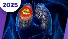 Pulmão não-pequenas células: doença localizada e localmente avançada